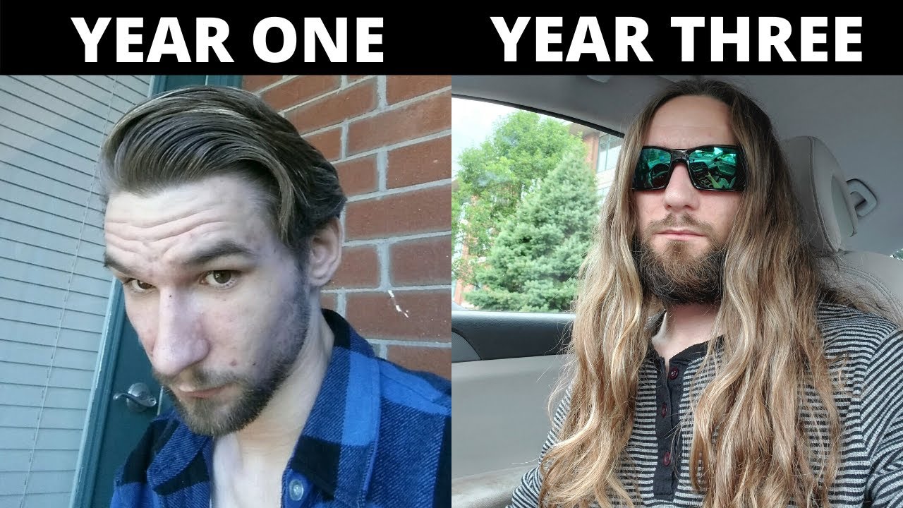 INSANE MEN'S HAIR GROWTH TRANSFORMATIONS (From Subscribers)