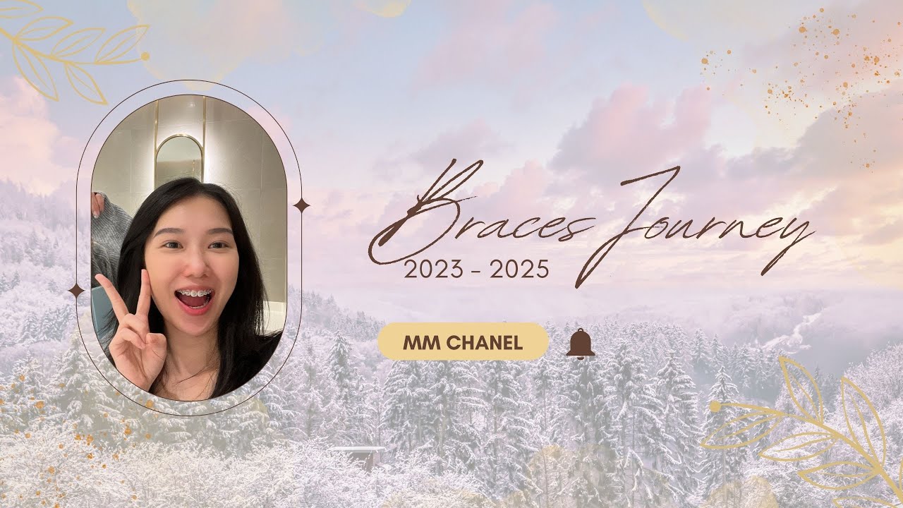 【VLOG】绑牙记录 2025 // Braces Journey