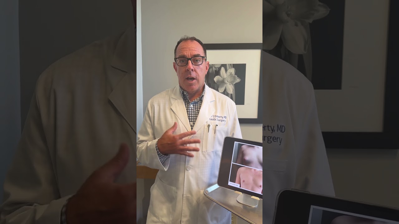 When should I get gynecomastia surgery? Board Certified Plastic Surgeon Sean Doherty explains