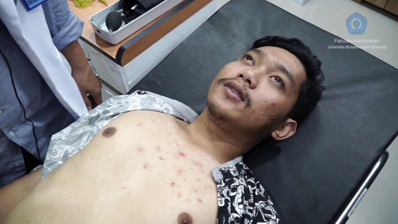 PANDUAN SKILLS LAB PEMERIKSAAN FISIK ABDOMEN FAKULTAS KEDOKTERAN UNIMUS