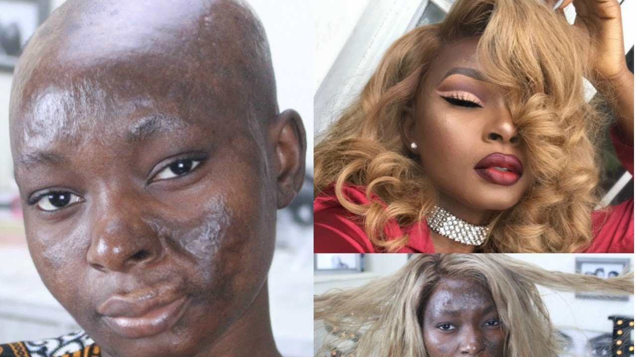 Extreme Makeover Transformation | Shalom Blac