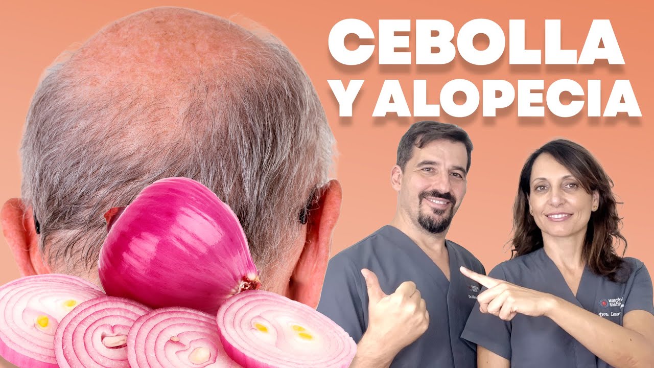🔴 Cómo Preparar y Utilizar CEBOLLA para el Cabello 🧅