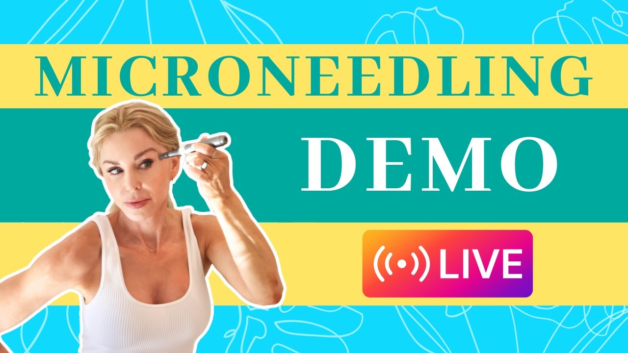 MICRONEEDLING DEMO! 🎙️That’s right, I am doing a FULL face Microneedling demo in today’s Instagram