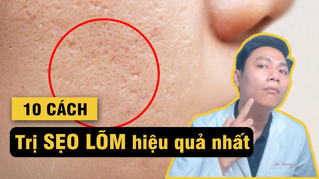 10 Cách điều trị SẸO LÕM, SẸO RỖ hiệu quả | Bác sĩ Trường