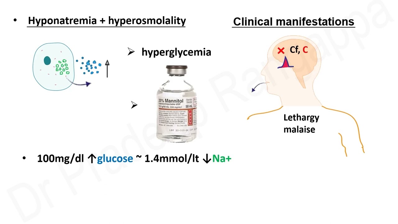 Hyponatremia  | Dr. Pradeep Rangappa