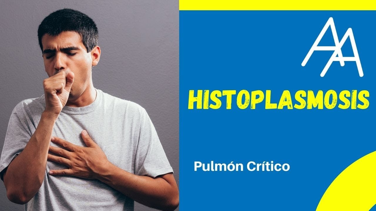 Histoplasmosis, hongo que enferma el pulmón