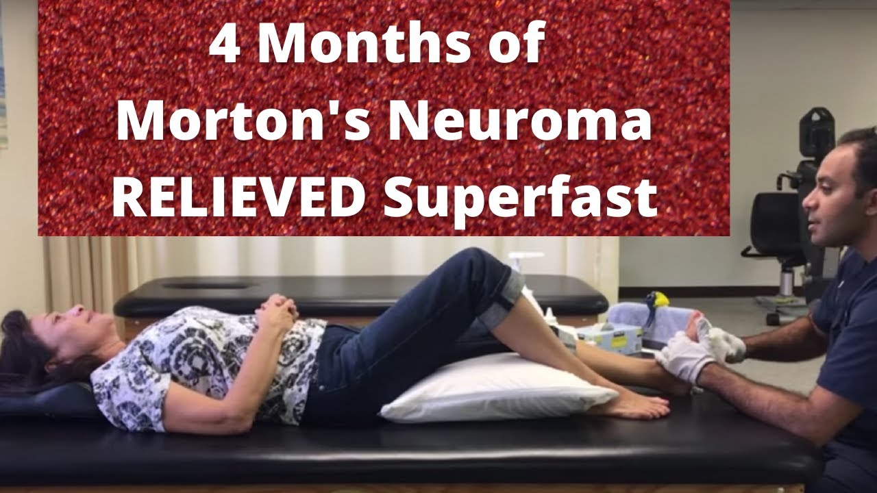Amazing Relief for Morton’s Neuroma (Nerve Entrapment)! (REAL RESULTS!!)