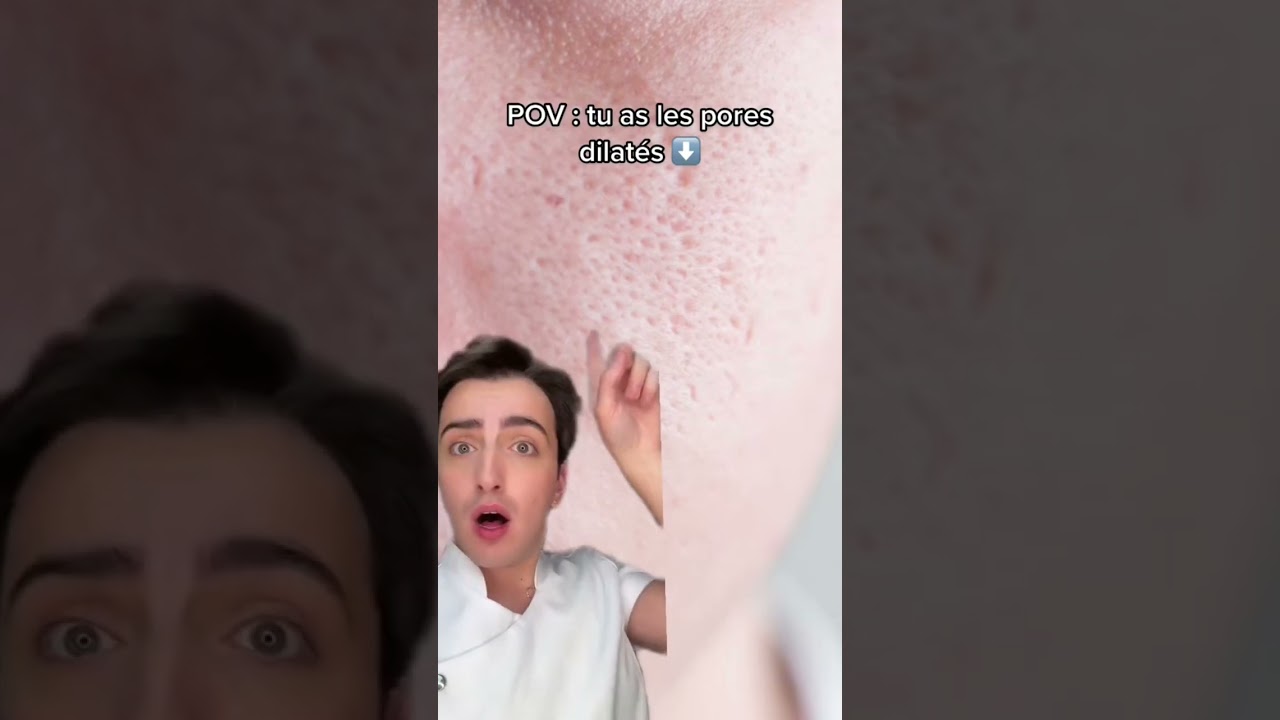 SE DÉBARRASSER DES PORES DILATÉS ✅ 