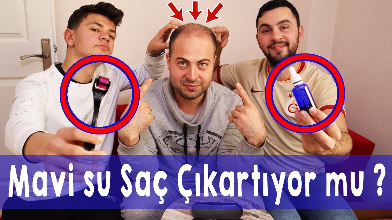 MAVİ SU Sa&ccedil; &Ccedil;ıkartıyor mu ?