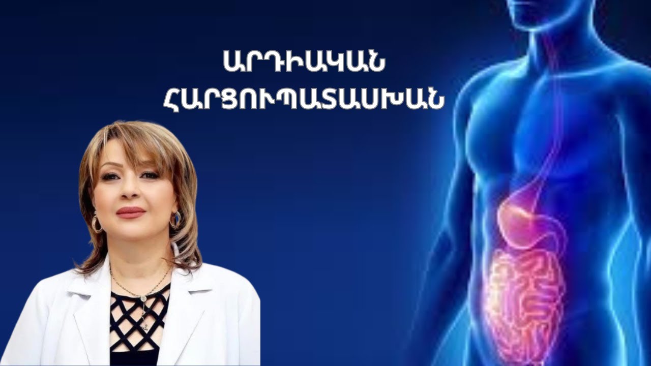 Արդիական հարցուպատասխան