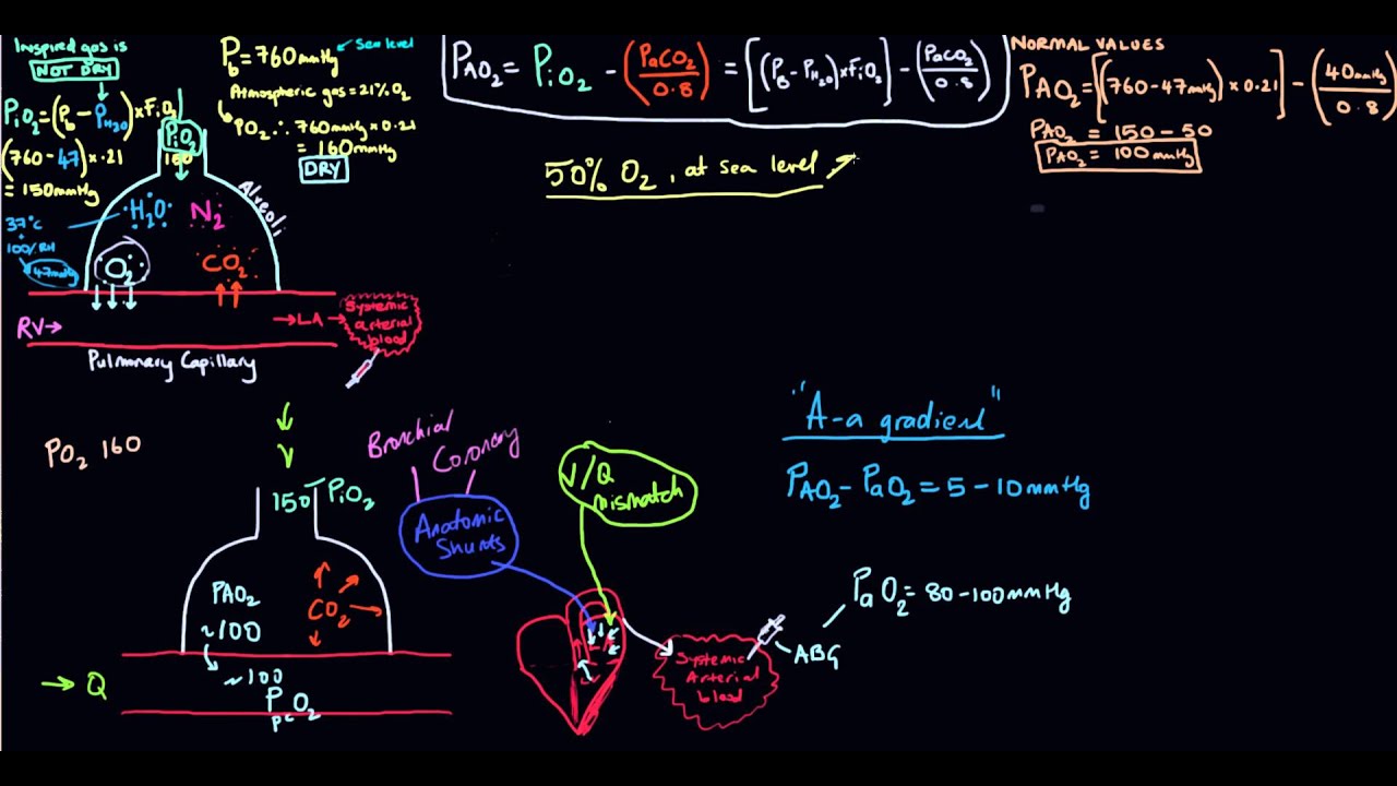 A-a gradient (Alveolar-arterial oxygen gradient)