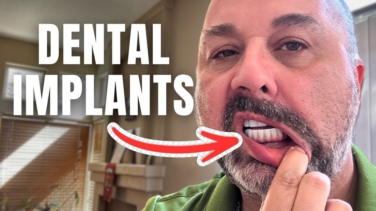 How Dental Implants Made Me Lose 40Lbs