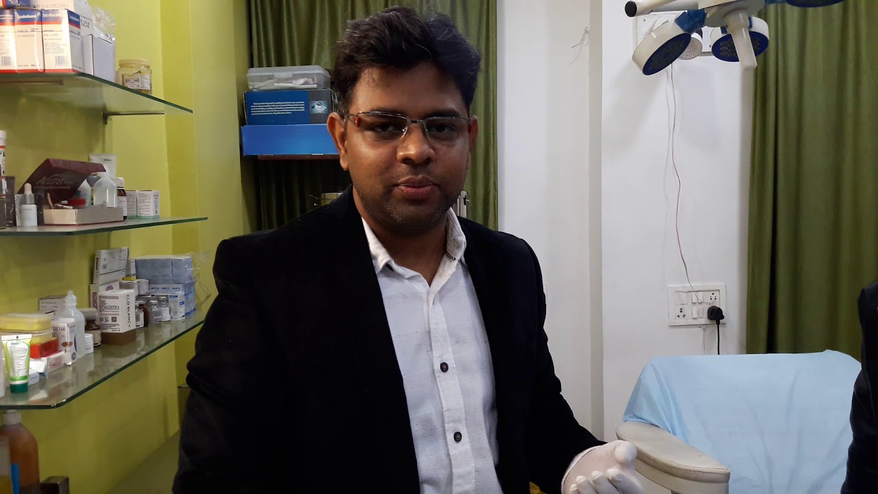 Hair transplant (patient 85) part 1