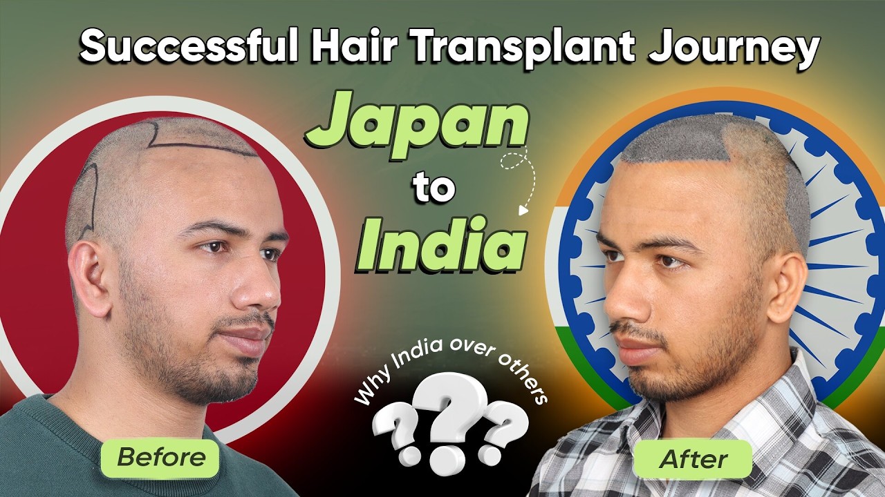 Hair Transplant in Kolkata (HX-YTRD) | Best Results & Cost of Hair Transplant in Kolkata.