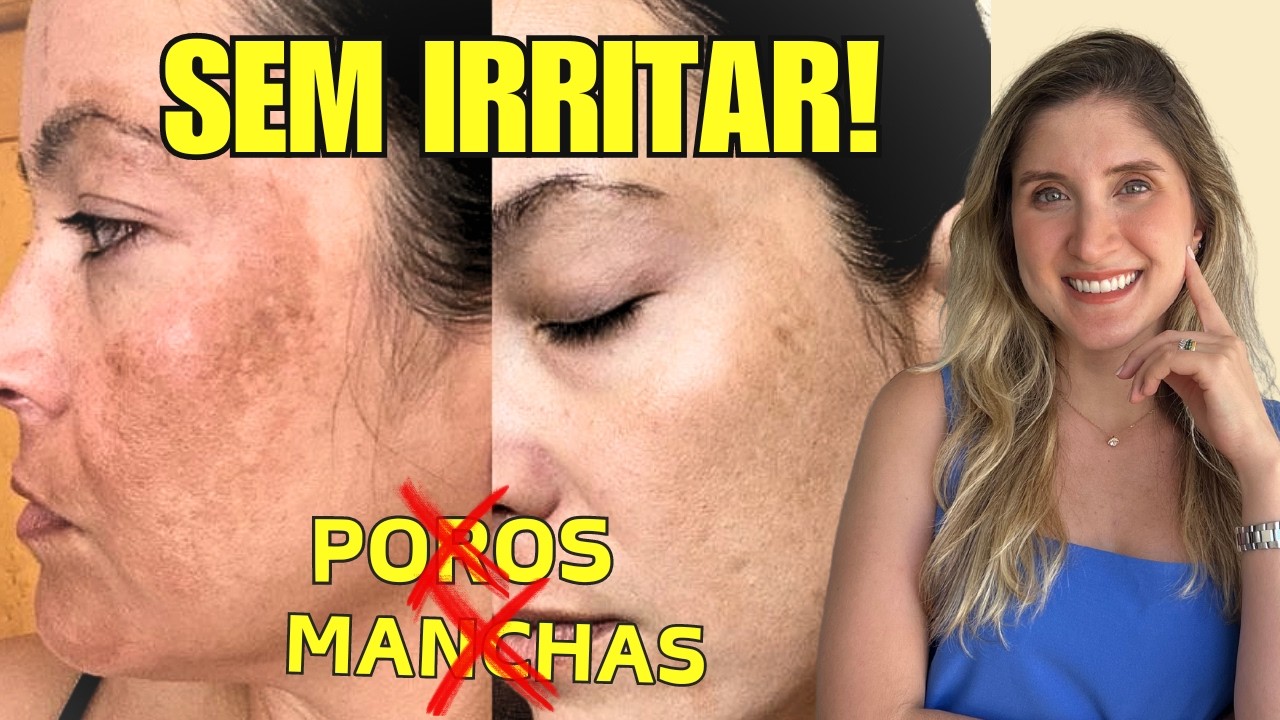 ÁCIDO GLICÓLICO- Clareia Manchas e Reduz Poros- [Dermato Explica Tudo]
