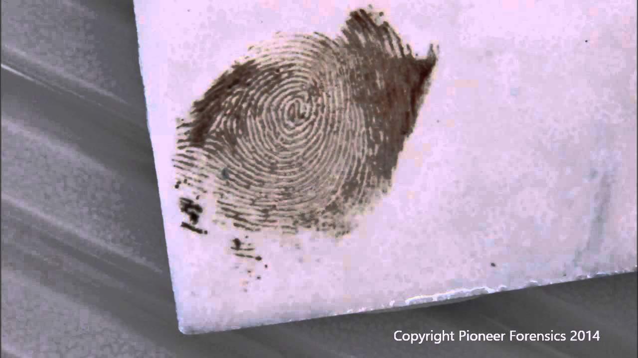 Amido Black 10B Process for Bloody Fingerprints