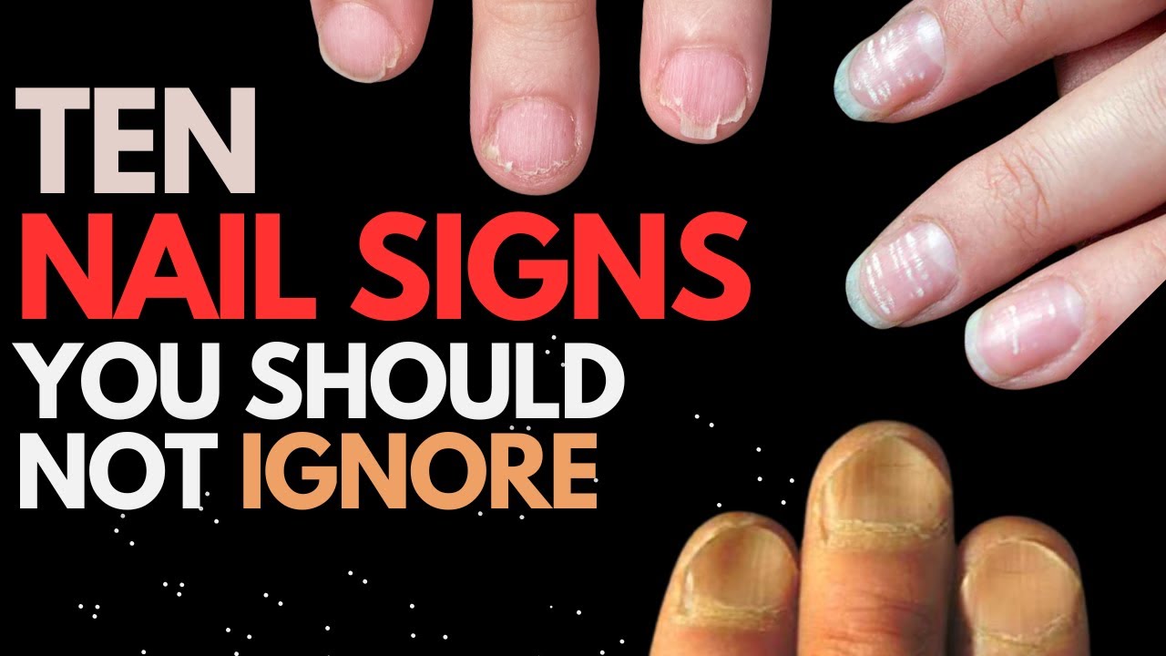 Nail Signs which can tell about your health #nailhealth #skincare #nails