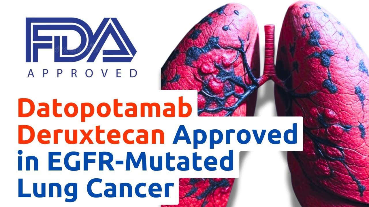 Datopotamab Deruxtecan EGFR-Mutated NSCLC: FDA Update 2025