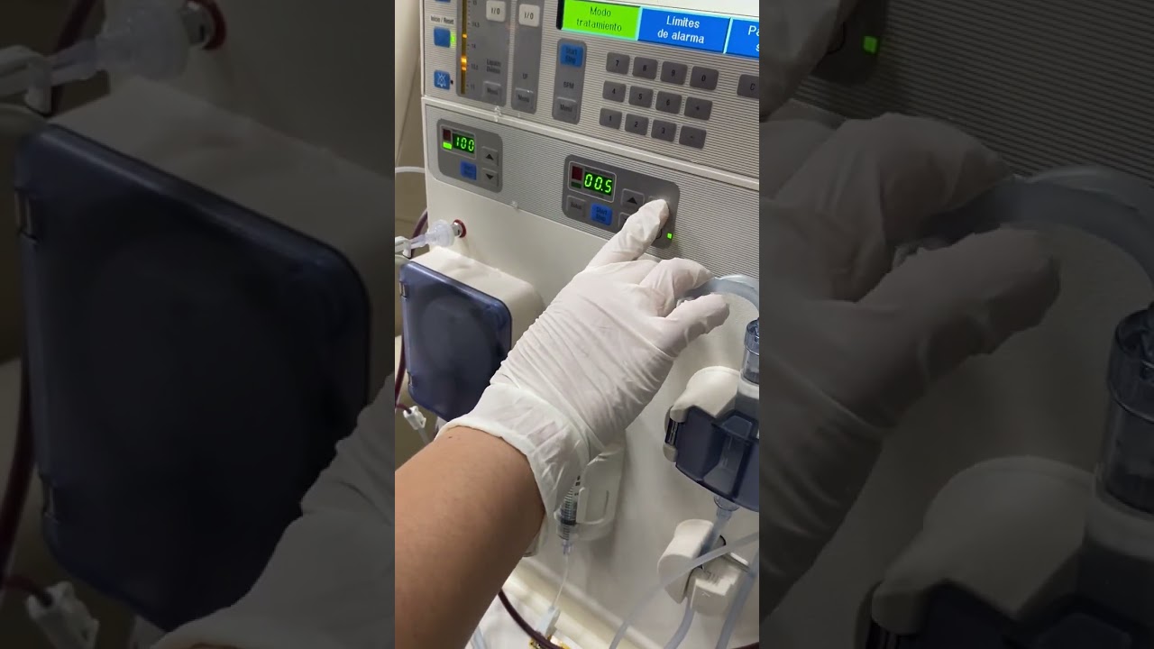 Conexión del paciente a la máquina de hemodiálisis Fresenius  inf cel 6622297646