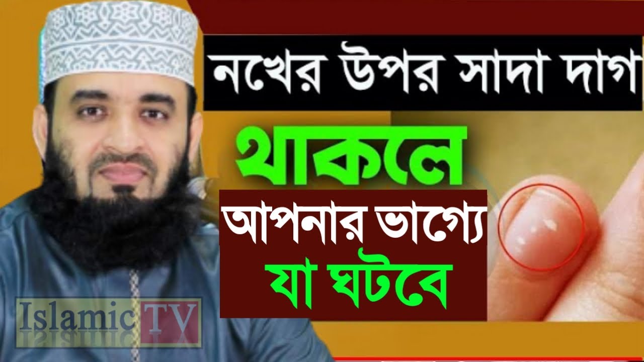 নখের উপর সাদা দাগ থাকলে আপনার ভাগ্যে যা ঘটবে। আজহারী তাং 02.02.26 EP-96
