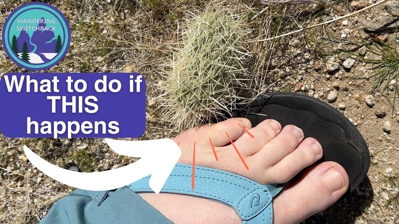 Switchback VS Cholla Cactus: Demonstration of Removing Cactus and Wound Care