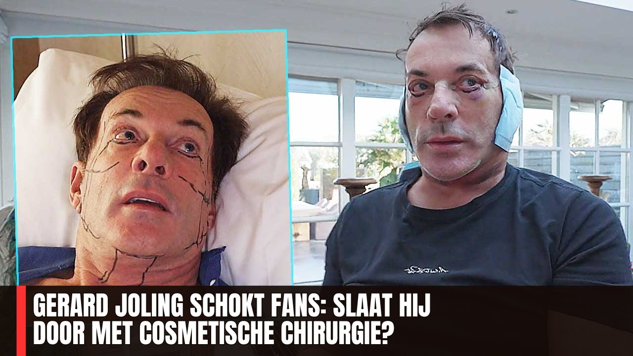 Gerard Joling Schokt Fans: Slaat Hij Door met Cosmetische Chirurgie?