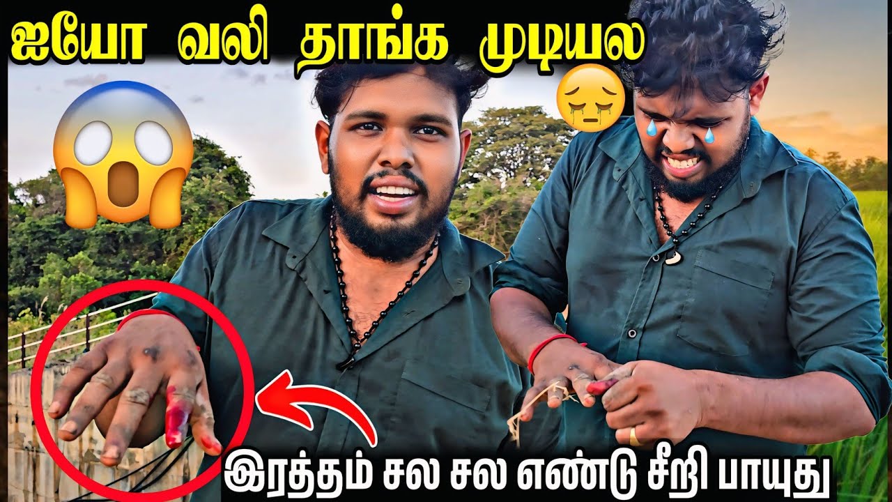 என்னை இரத்த பொலி எடுத்த கரையாக்கன் 😱| voice of Anushan