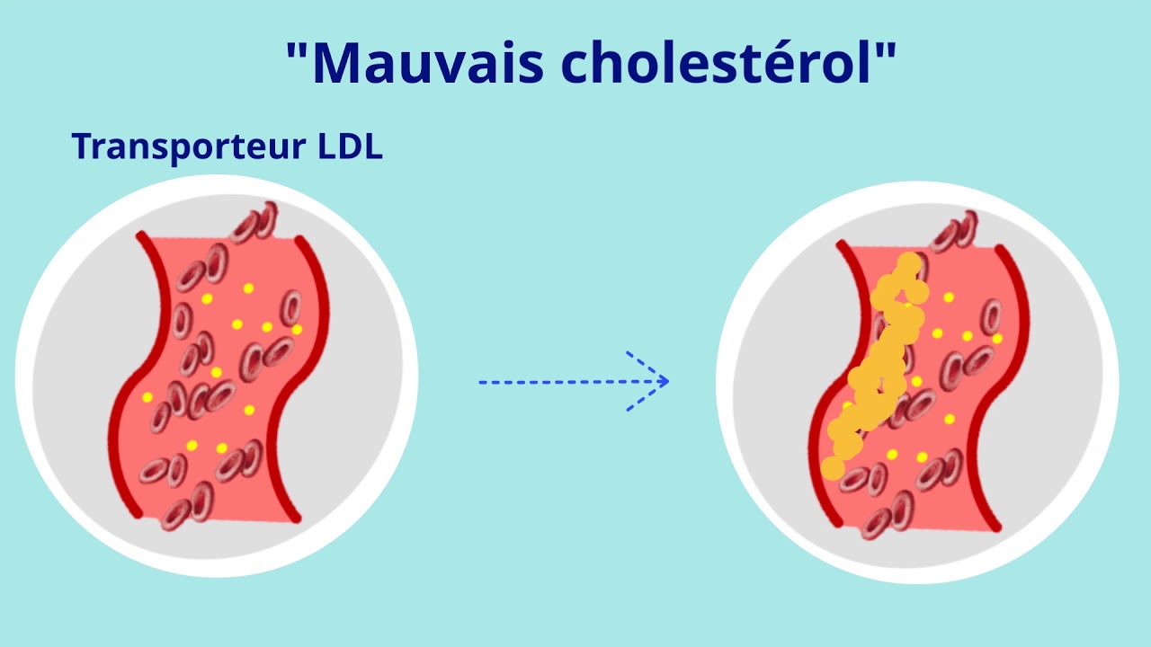 Autour du cœur - Le Cholestérol