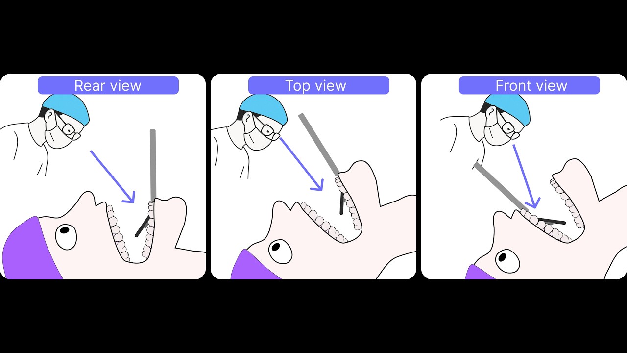 How to Position Yourself at the Dental Chair | Ergonomics Guide for Dentists