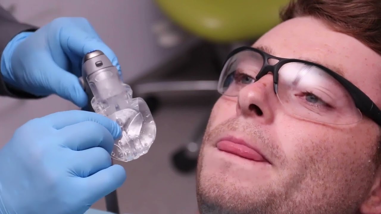 Posterior Mouthpiece Sizing and Placement