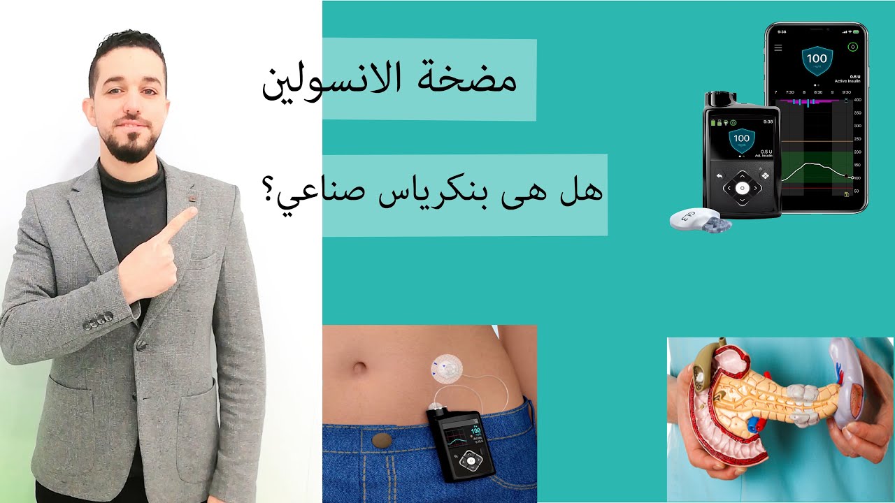 (Medtronic 640,670,780)  ماهي مضخة الانسولين؟|الفرق بين أنواع مضخة الانسولين