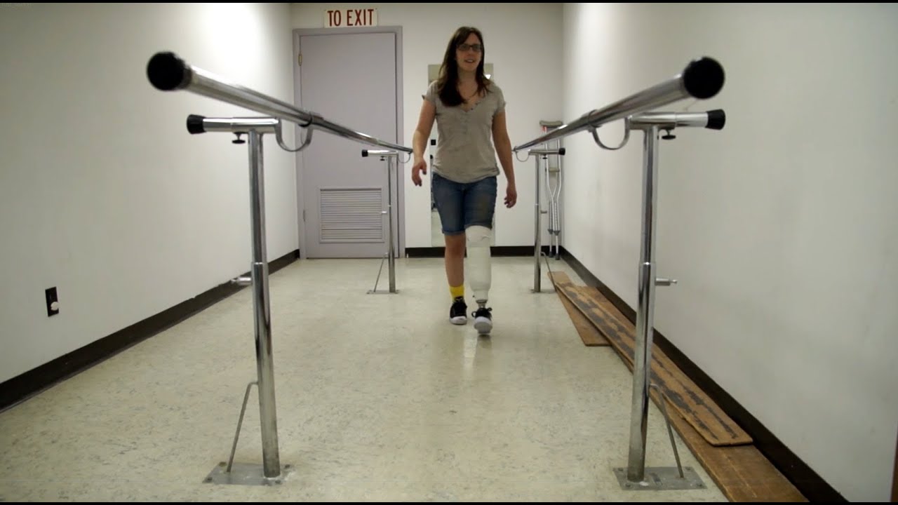 AmputeeOT: First time walking after my below knee amputation with check socket!
