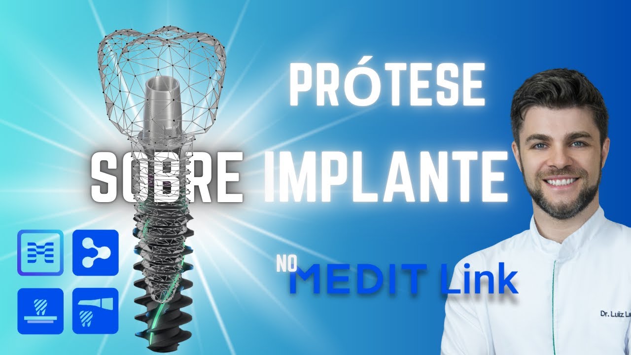 Como Fazer Coroa Sobre Implante no MeditLink | Passo a Passo no Fluxo Digital