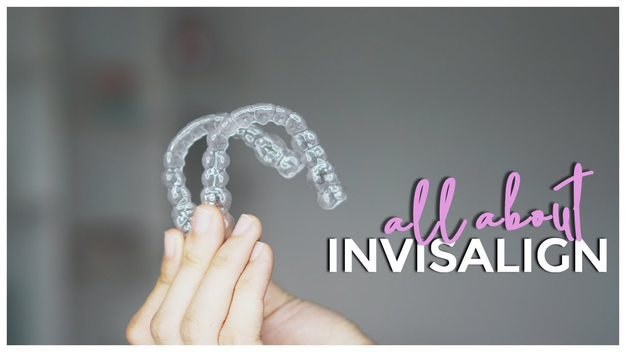 MY INVISALIGN JOURNEY! Is it Worth it? | Philippines