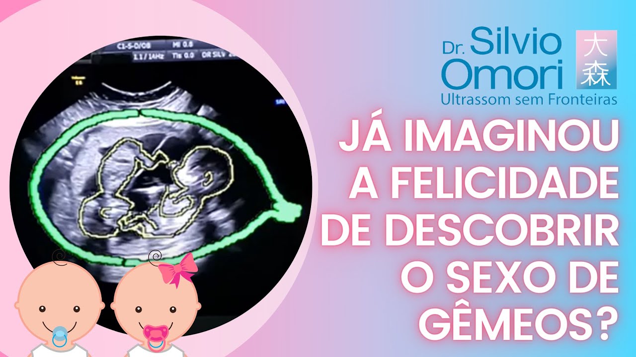 Já imaginou a felicidade de descobrir o sexo de gêmeos?