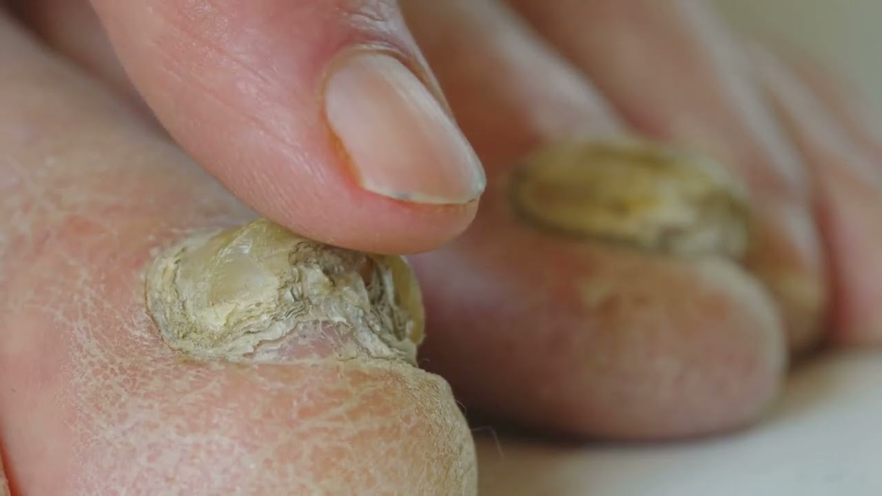 invideo ai 1080 Revolutionary Medical Pedicure  Relax & Heal! 2025 07 17T23 02 54