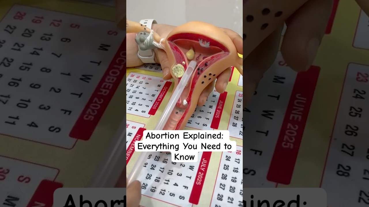 Abortion Explained: Everything You Need to Know #pregnancy #baby #babyboy #newborn #pregnant #trend