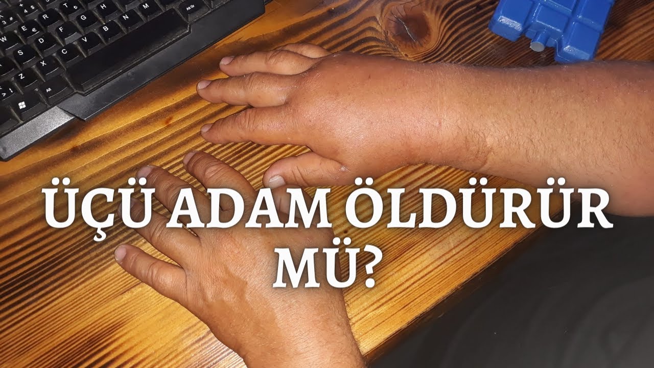 3'ü adam öldürür denen arıya bulaşmanın bedeli (Vespa orientalis) Doğu eşekarısı