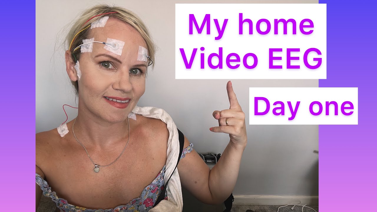 Epilepsy - My home video EEG vlog (vaEEG) day one