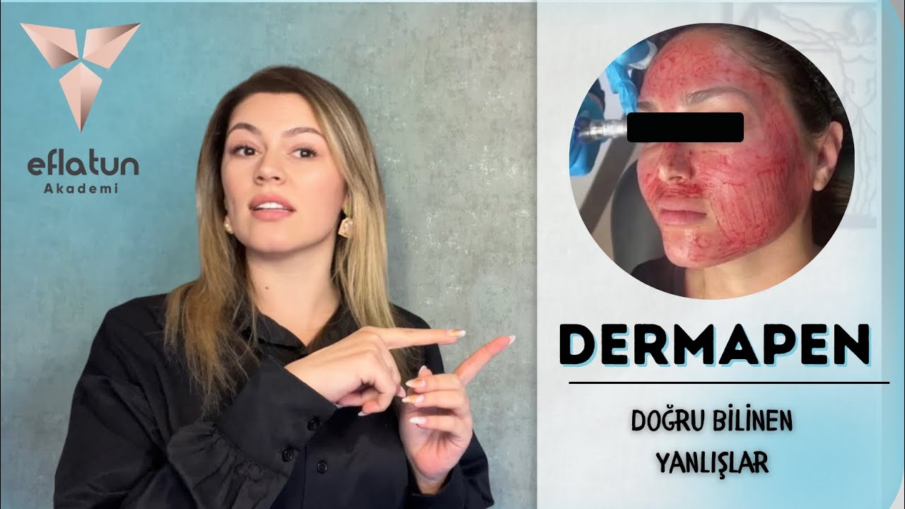 Dermapen Gerçeği: Doğru Bilinen Yanlışları Açıklıyoruz!