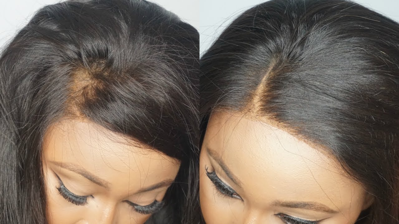 ChrissyBales || Is Your frontal : Balding? Receding? Ripped? Change frontal? YES it can be fixed.