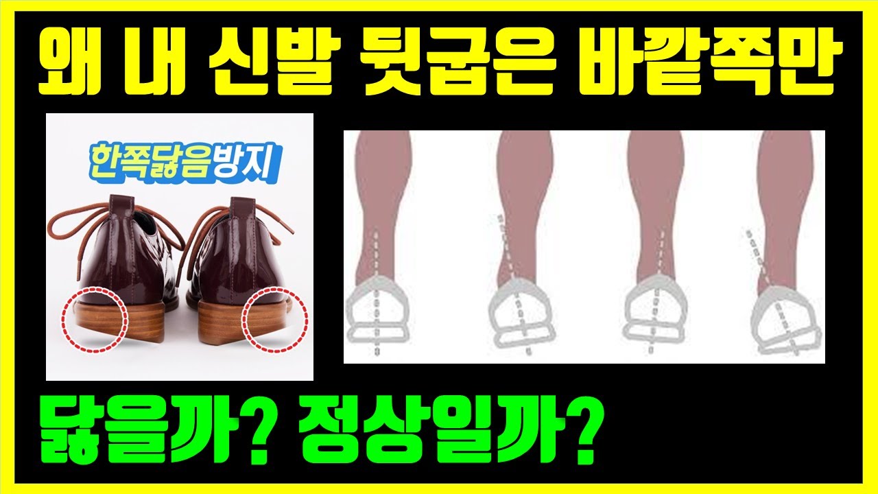 신발 뒤꿈치의 바깥쪽이 닳는 게 정상일까? 올바른 걷기 시 바닥에 가장 먼저 닿는 부분은?
