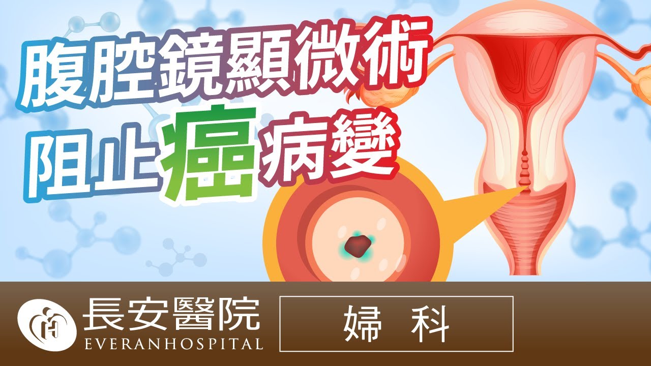 【長安的故事】婦科 子宮頸癌 腹腔鏡顯微手術 個案分享 - 董小姐