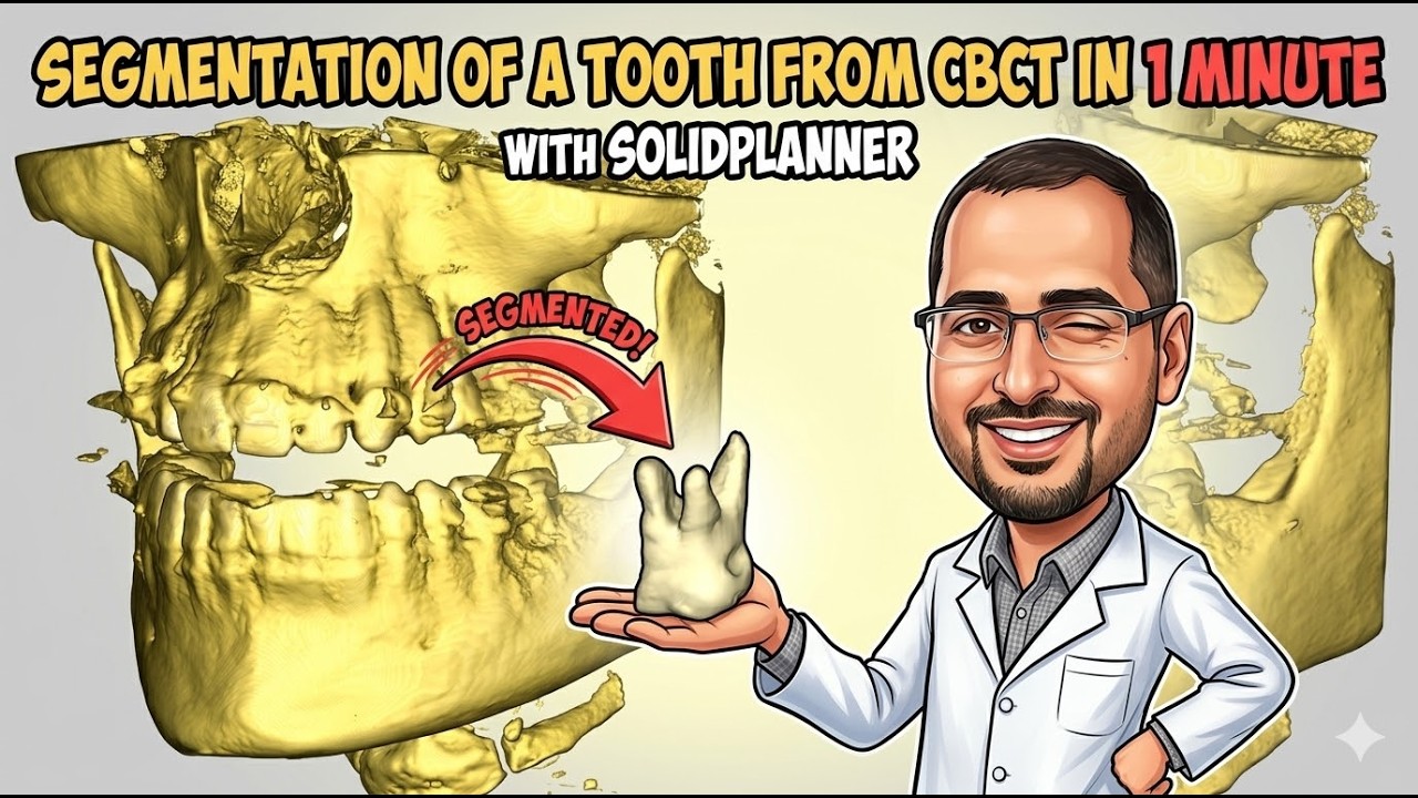 Tooth Segmentation from CBCT in 1 Minute — Step by Step