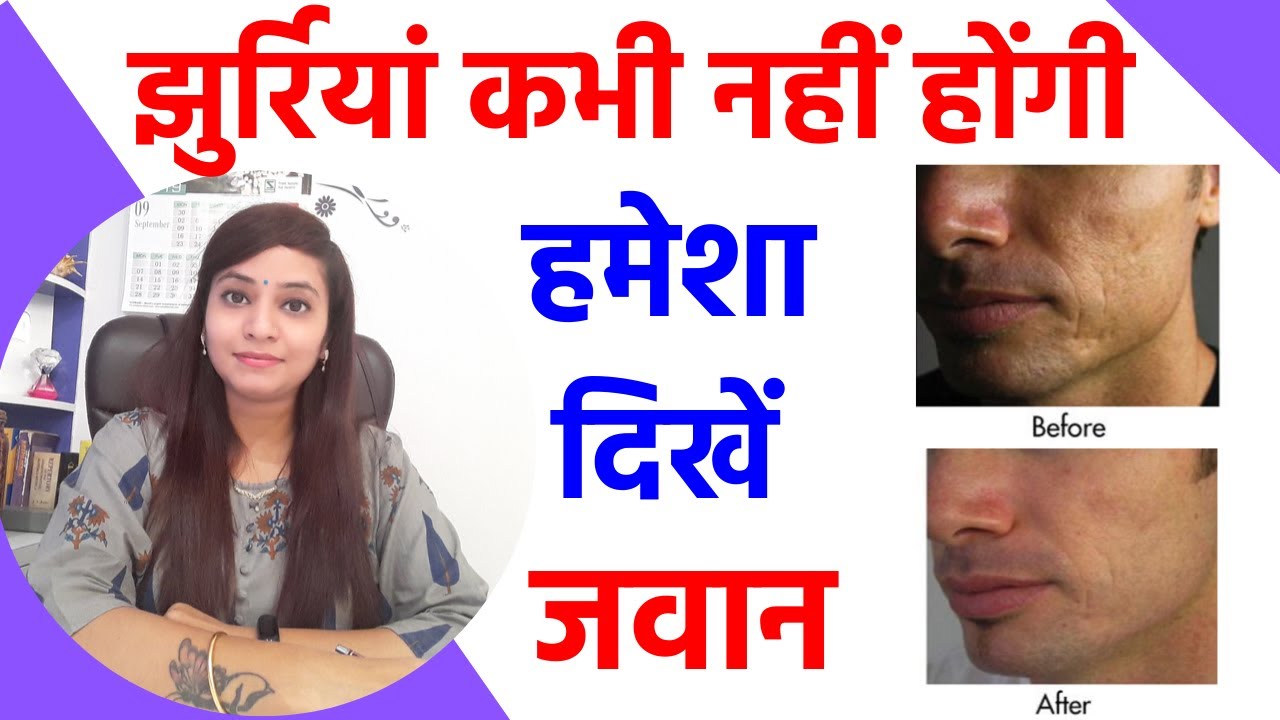 झुर्रियां ख़तम करने का तरीका एवं उपाय | झुर्रियों के लिए फेस पैक | चेहरे को टाइट करने का तरीका