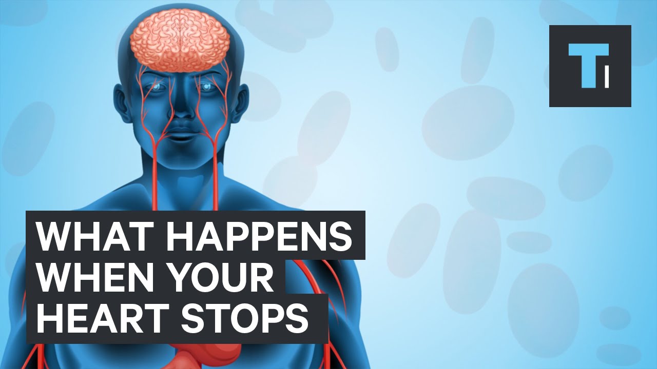 What happens when your heart stops