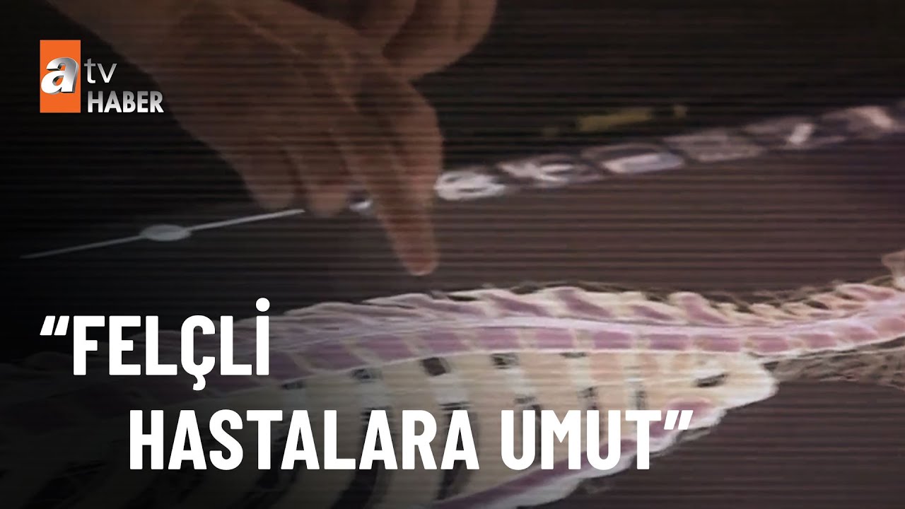 Felçlilere elektrikli tedavi cihazı - atv Haber 16 Kasım 2022