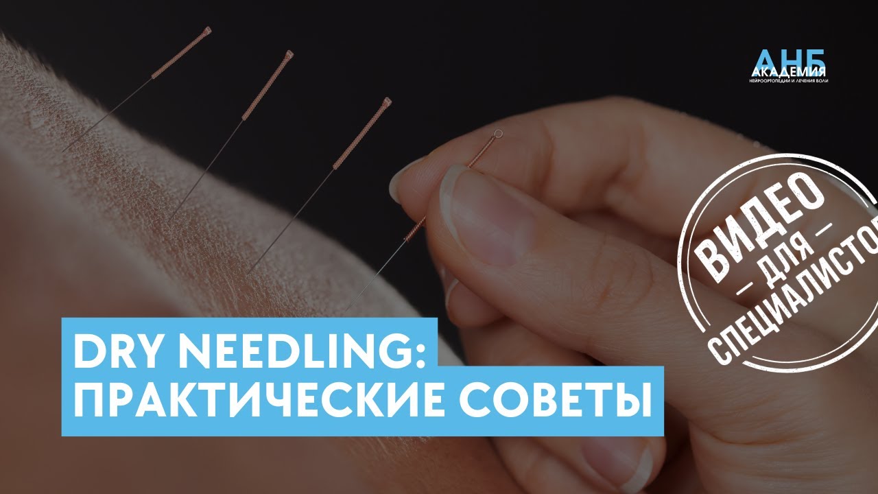 Dry needling: практические советы для начинающих