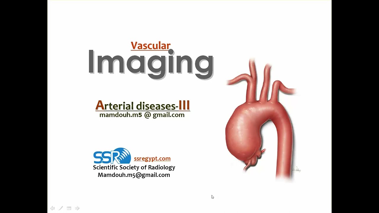 9 Vascular imaging Arteries III TC