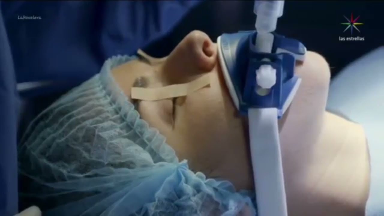 Coma